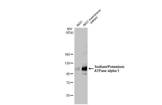A431 whole cell and membrane extracts (30 ug) were separated by 7.5% SDS-PAGE, and the membrane was blotted with Sodium/Potassium ATPase alpha 1 antibody [HL114] (NBP3-13660) diluted at 1:500. The HRP-conjugated anti-rabbit IgG antibody  was used to detect the primary antibody. 