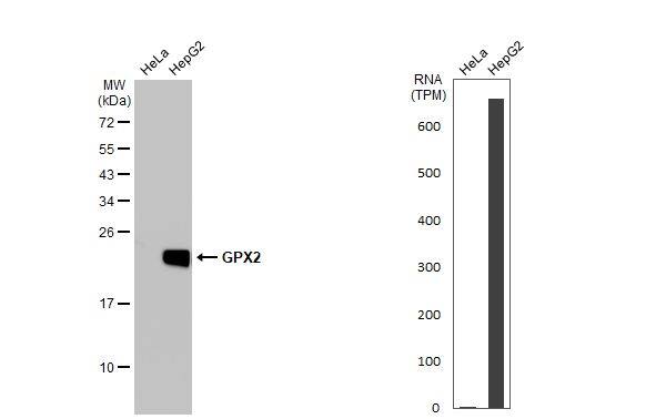 Various whole cell extracts (30 ug) were separated by 12% SDS-PAGE, and the membrane was blotted with GPX2 antibody [HL125] (NBP3-13662) diluted at 1:1000. The HRP-conjated anti-rabbit IgG antibody  was used to detect the primary antibody. Corresponding RNA expression data for the same cell lines are based on Human Protein Atlas program. 