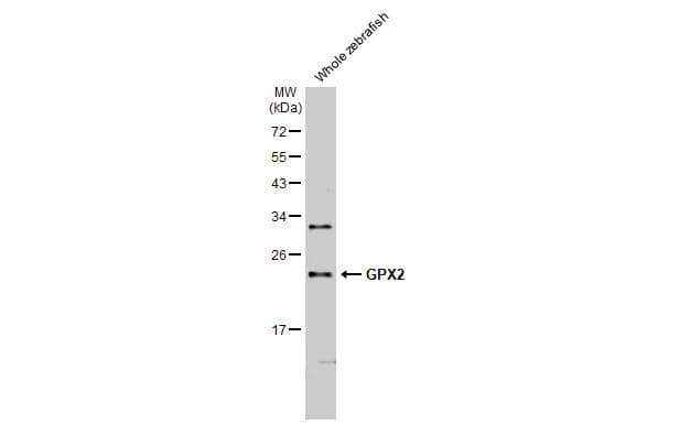 Whole zebrafish extract (30 ug) was separated by 12% SDS-PAGE, and the membrane was blotted with GPX2 antibody [HL125] (NBP3-13662) diluted at 1:1000. The HRP-conjugated anti-rabbit IgG antibody  was used to detect the primary antibody, and the signal was developed with Trident ECL plus-Enhanced. 