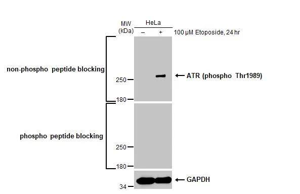 Untreated (-) and treated (+) HeLa whole cell extracts (30 ug) were separated by 5% SDS-PAGE, and the membrane was blotted with ATR (phospho Thr1989) antibody [HL132] (NBP3-13665) diluted at 1:500. The HRP-conjugated anti-rabbit IgG antibody  was used to detect the primary antibody, and the signal was developed with Trident ECL plus-Enhanced. 