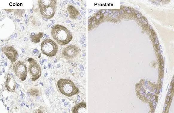 Immunohistochemistry-Paraffin: FACL4 Antibody (HL229) [NBP3-13666] - FACL4 antibody [HL44] detects FACL4 protein by immunohistochemical analysis.Sample: Paraffin-embedded rat tissues.FACL4 stained by FACL4 antibody [HL44] (NBP3-13666) diluted at 1:100.Antigen Retrieval: Citrate buffer, pH 6.0, 15 min