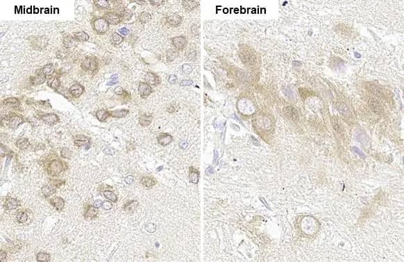 Immunohistochemistry-Paraffin: GLI-1 Antibody (HL247) [NBP3-13667] - GLI-1 antibody [HL27] detects GLI-1 protein by immunohistochemical analysis.Sample: Paraffin-embedded rat tissues.GLI-1 stained by GLI-1 antibody [HL27] (NBP3-13667) diluted at 1:100.Antigen Retrieval: Citrate buffer, pH 6.0, 15 min