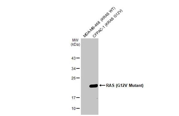 Various whole cell extracts (30 ug) were separated by 12% SDS-PAGE, and the membrane was blotted with RAS (G12V Mutant) antibody [HL169] (NBP3-13668) diluted at 1:1000. The HRP-conjugated anti-rabbit IgG antibody  was used to detect the primary antibody. 