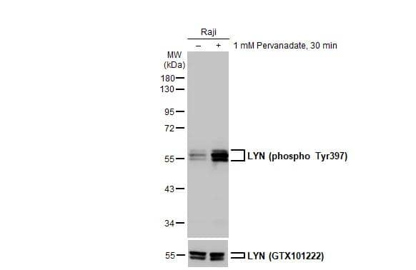 Untreated (-) and treated (+) Raji whole cell extracts (30 ug) were separated by 10% SDS-PAGE, and the membrane was blotted with LYN (phospho Tyr397) antibody [HL122] (NBP3-13673) diluted at 1:1000. The HRP-conjugated anti-rabbit IgG antibody  was used to detect the primary antibody. 