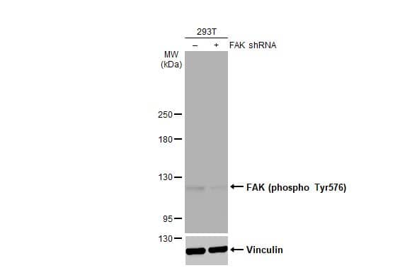 <b>Genetic Strategies Validation. </b>Western Blot: FAK [p Tyr576] Antibody (HL127) [NBP3-13675] - Non-transfected (–) and transfected (+) 293T whole cell extracts (30 ug) were separated by 5% SDS-PAGE, and the membrane was blotted with FAK (phospho Tyr576) antibody [HL127]  diluted at 1:2000. The HRP-conjugated anti-rabbit IgG antibody  was used to detect the primary antibody, and the signal was developed with Trident ECL plus-Enhanced.