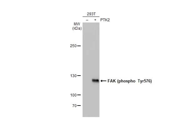 Western Blot: FAK [p Tyr576] Antibody (HL127) [NBP3-13675] - Non-transfected (-) and transfected (+) 293T whole cell extracts (30 ug) were separated by 5% SDS-PAGE, and the membrane was blotted with FAK antibody [HL127] (NBP3-13675) diluted at 1:5000. The HRP-conjugated anti-rabbit IgG antibody  was used to detect the primary antibody.