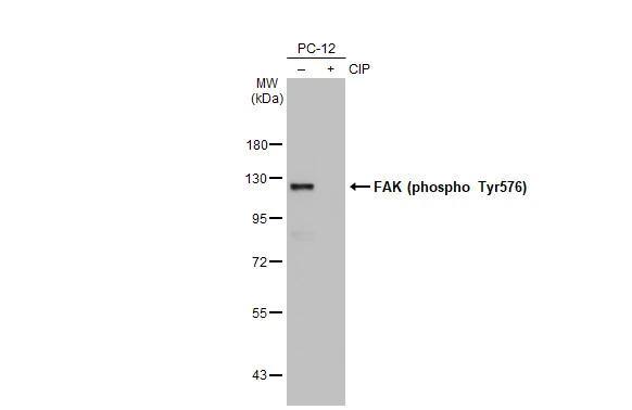 Untreated (-) and treated (+) PC-12 whole cell extracts (30 ug) were separated by 7.5% SDS-PAGE, and the membrane was blotted with FAK (phospho Tyr576) antibody [HL127] (NBP3-13675) diluted at 1:500. The HRP-conjugated anti-rabbit IgG antibody  was used to detect the primary antibody. 