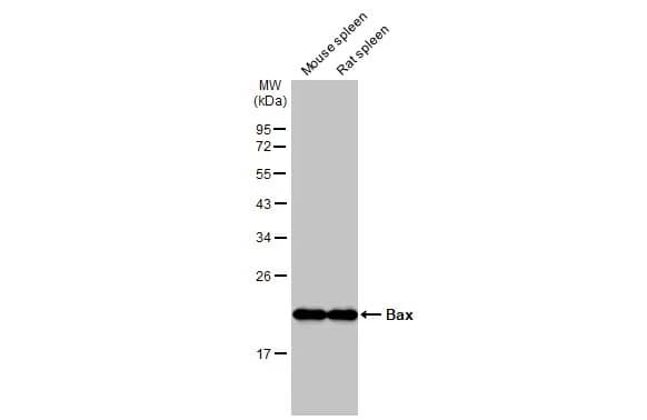 Western Blot: Bax Antibody (HL236) [NBP3-13676] - Various tissue extracts (50 ug) were separated by 12% SDS-PAGE, and the membrane was blotted with Bax antibody [HL236] (NBP3-13676) diluted at 1:1000. The HRP-conjugated anti-rabbit IgG antibody  was used to detect the primary antibody.