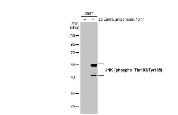 Western Blot: JNK1 [p Thr183, p Tyr185] Antibody (HL1008) [NBP3-13678] - Untreated (-) and treated (+) 293T whole cell extract (30 ug) were separated by 10% SDS-PAGE, and the membrane was blotted with JNK1 antibody [HL1008] (NBP3-13678) diluted at 1:1000. The HRP-conjugated anti-rabbit IgG antibody  was used to detect the primary antibody.