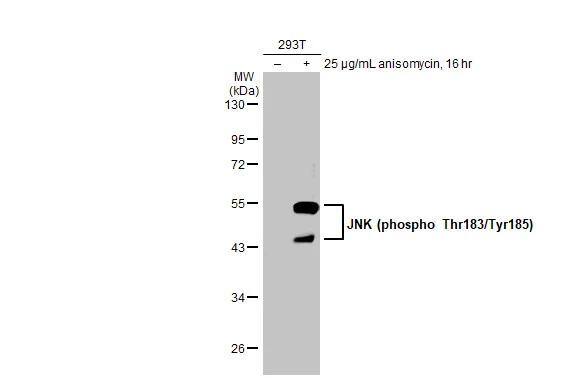 Untreated (-) and treated (+) 293T whole cell extracts (30 ug) were separated by 10% SDS-PAGE, and the membrane was blotted with JNK (phospho Thr183/Tyr185) antibody [HL1008] (NBP3-13678) diluted at 1:500. The HRP-conjugated anti-rabbit IgG antibody  was used to detect the primary antibody. 
