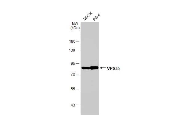 Western Blot: VPS35 Antibody (HL1017) [NBP3-13680] - Various whole cell extracts (30 ug) were separated by 7.5% SDS-PAGE, and the membrane was blotted with VPS35 antibody [HL1017] (NBP3-13680) diluted at 1:1000. The HRP-conjugated anti-rabbit IgG antibody  was used to detect the primary antibody.