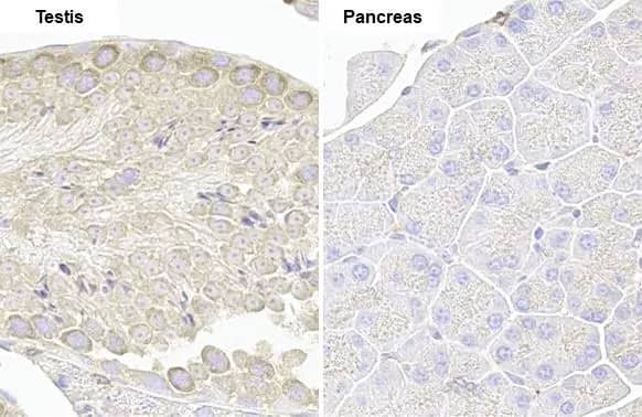 Immunohistochemistry-Paraffin: VPS35 Antibody (HL1017) [NBP3-13680] - VPS35 antibody [HL1017] detects VPS35 protein by immunohistochemical analysis.Sample: Paraffin-embedded mouse tissue.VPS35 stained by VPS35 antibody [HL1017] (NBP3-13680) diluted at 1:100.Antigen Retrieval: Citrate buffer, pH 6.0, 15 min