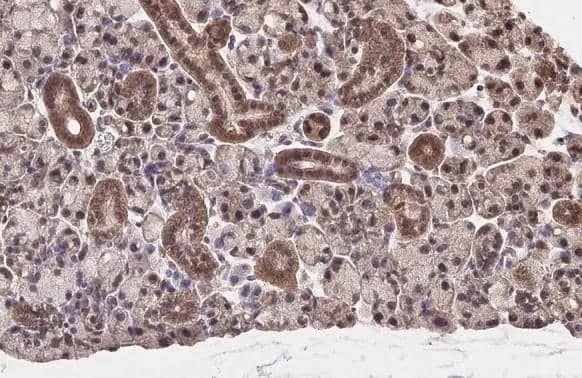 NRF2 antibody [HL1021] detects NRF2 protein at cytoplasm and nucleus by immunohistochemical analysis.Sample: Paraffin-embedded mouse salivary gland.NRF2 stained by NRF2 antibody [HL1021] (NBP3-13682) diluted at 1:100.Antigen Retrieval: Citrate buffer, pH 6.0, 15 min 