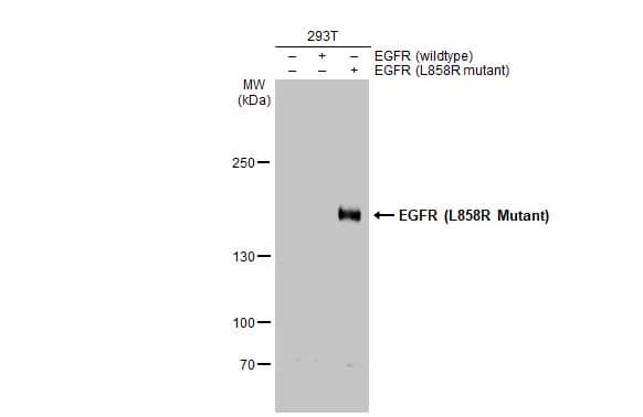 Western Blot: EGFR Antibody (HL1022) - L858R Mutant [NBP3-13683] - Non-transfected (-) and transfected (+) 293T whole cell extracts (30 ug) were separated by 5% SDS-PAGE, and the membrane was blotted with EGFR antibody [HL1022] (NBP3-13683) diluted at 1:5000. The HRP-conjugated anti-rabbit IgG antibody  was used to detect the primary antibody.