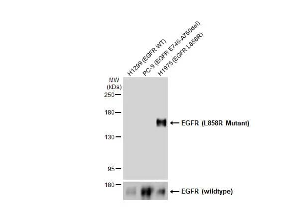 Western Blot: EGFR Antibody (HL1022) - L858R Mutant [NBP3-13683] - Various whole cell extracts (30 | 15 | 15 ug) were separated by 5% SDS-PAGE, and the membrane was blotted with EGFR antibody [HL1022] (NBP3-13683) diluted at 1:1000. The HRP-conjugated anti-rabbit IgG antibody  was used to detect the primary antibody.