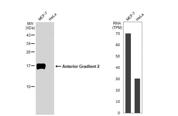 <b>Orthogonal Strategies Validation. </b>Western Blot: AG-2/AGR2 Antibody (HL1024) [NBP3-13684] - Various whole cell extracts (30 ug) were separated by 15% SDS-PAGE, and the membrane was blotted with Anterior Gradient 2 antibody [HL1024]  diluted at 1:1000. The HRP-conjugated anti-rabbit IgG antibody  was used to detect the primary antibody.