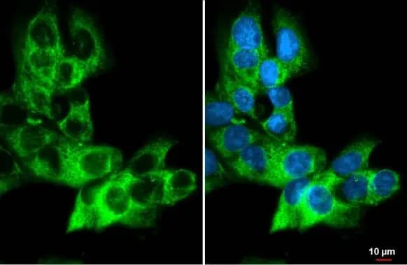 Immunocytochemistry/ Immunofluorescence: AG-2/AGR2 Antibody (HL1024) [NBP3-13684] - AG-2/AGR2 antibody [HL1024] detects AG-2/AGR2 protein at cytoplasm by immunofluorescent analysis.Sample: MCF-7 cells were fixed in ice-cold MeOH for 5 min.Green: AG-2/AGR2 stained by AG-2/AGR2 antibody [HL1024] (NBP3-13684) diluted at 1:500.Blue: Fluoroshield with DAPI .