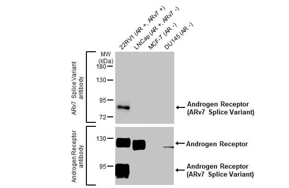 Western Blot: Androgen R/NR3C4 Antibody (HL1028) - ARv7 Variant [NBP3-13685] - Various whole cell extracts (30 ug) were separated by 7.5% SDS-PAGE, and the membrane was blotted antibodies as follows:  Upper image : Androgen Receptor (ARv7 Splice Variant) antibody [HL1028], GTX635842 (1:1000)  Lower image : Androgen Receptor antibody [HL1049], GTX636021.  The HRP-conjugated anti-rabbit IgG antibody  was used to detect the primary antibody.