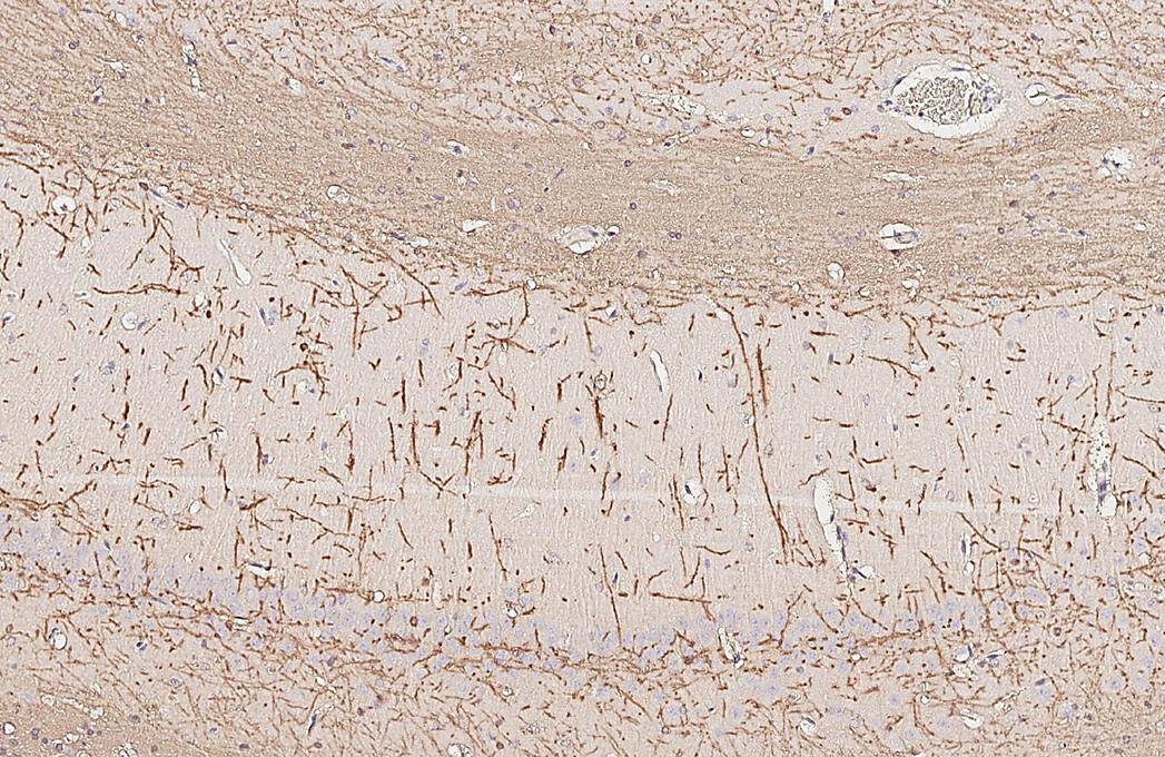 Myelin basic protein antibody [HL1033] detects Myelin basic protein protein by immunohistochemical analysis.Sample: Paraffin-embedded rat hippocampus.Myelin basic protein stained by Myelin basic protein antibody [HL1033] (NBP3-13687) diluted at 1:200.Antigen Retrieval: Citrate buffer, pH 6.0, 15 min 