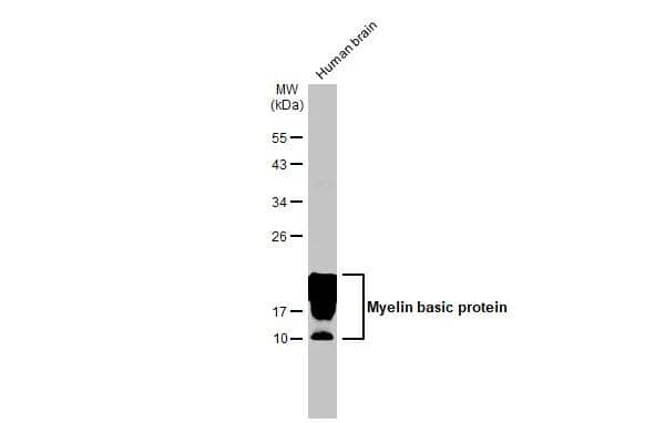 Human tissue extract (30 ug) was separated by 12% SDS-PAGE, and the membrane was blotted with Myelin basic protein antibody [HL1033] (NBP3-13687) diluted at 1:10000. The HRP-conjugated anti-rabbit IgG antibody  was used to detect the primary antibody. 