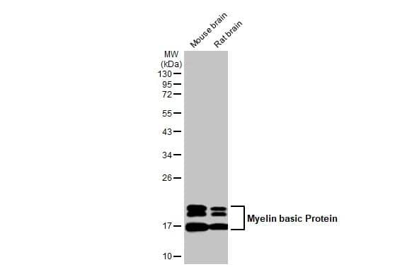 Various tissue extracts (50 ug) were separated by 12% SDS-PAGE, and the membrane was blotted with Myelin basic Protein antibody [HL1033] (NBP3-13687) diluted at 1:500000. The HRP-conjugated anti-rabbit IgG antibody  was used to detect the primary antibody. 