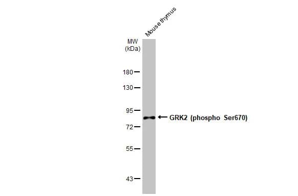 Western Blot: GRK2 [p Ser670] Antibody (HL1035) [NBP3-13688] - Various tissue extracts (50 ug) was separated by 7.5% SDS-PAGE, and the membrane was blotted with GRK2 antibody [HL1035] (NBP3-13688) diluted at 1:500. The HRP-conjugated anti-rabbit IgG antibody  was used to detect the primary antibody.