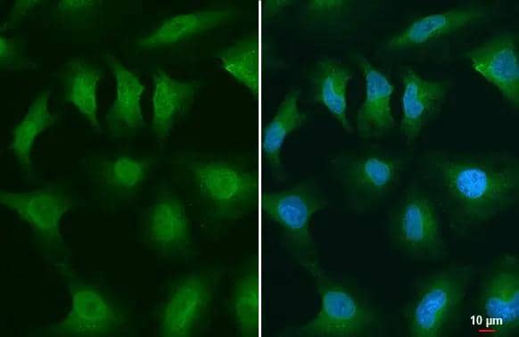 GSK3 beta antibody detects GSK3 beta protein at nucleus by immunofluorescent analysis.Sample: HeLa cells were fixed in 4% paraformaldehyde at RT for 15 min.Green: GSK3 beta stained by GSK3 beta antibody (NBP3-13691) diluted at 1:500. 