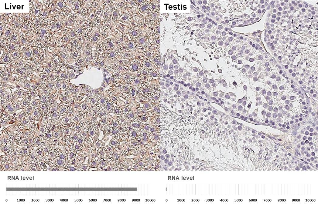 Apolipoprotein E antibody [GT27711] detects Apolipoprotein E protein by immunohistochemical analysis.Sample: Paraffin-embedded mouse tissues.Apolipoprotein E stained by Apolipoprotein E antibody [GT27711] (NBP3-13692) diluted at 1:200.Antigen Retrieval: Citrate buffer, pH 6.0, 15 min 