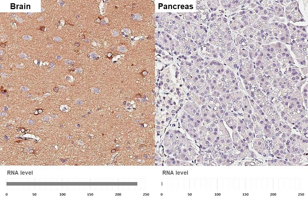 Apolipoprotein E antibody [GT27711] detects Apolipoprotein E protein by immunohistochemical analysis.Sample: Paraffin-embedded human tissues.Apolipoprotein E stained by Apolipoprotein E antibody [GT27711] (NBP3-13692) diluted at 1:200.Antigen Retrieval: Citrate buffer, pH 6.0, 15 min 