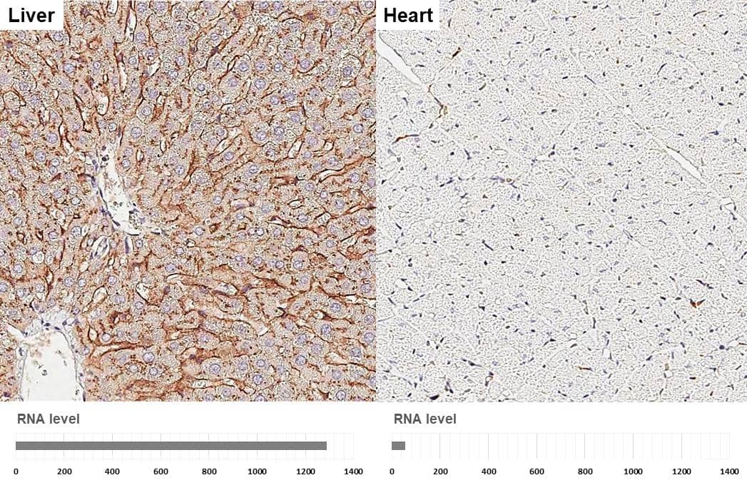 Apolipoprotein E antibody [GT27711] detects Apolipoprotein E protein by immunohistochemical analysis.Sample: Paraffin-embedded rat tissues.Apolipoprotein E stained by Apolipoprotein E antibody [GT27711] (NBP3-13692) diluted at 1:200.Antigen Retrieval: Citrate buffer, pH 6.0, 15 min 