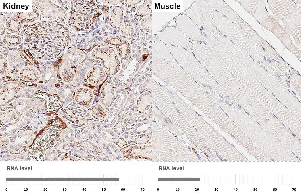 Apolipoprotein E antibody [GT27711] detects Apolipoprotein E protein by immunohistochemical analysis.Sample: Paraffin-embedded rat tissues.Apolipoprotein E stained by Apolipoprotein E antibody [GT27711] (NBP3-13692) diluted at 1:200.Antigen Retrieval: Citrate buffer, pH 6.0, 15 min 