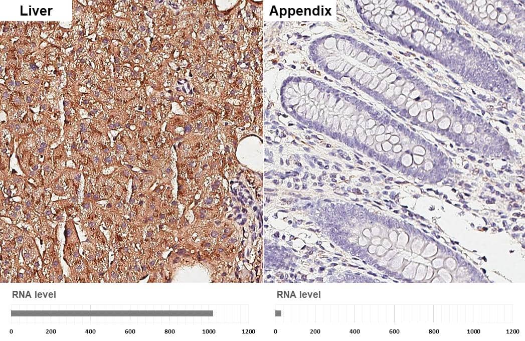 Apolipoprotein E antibody [GT27711] detects Apolipoprotein E protein by immunohistochemical analysis.Sample: Paraffin-embedded human tissues.Apolipoprotein E stained by Apolipoprotein E antibody [GT27711] (NBP3-13692) diluted at 1:200.Antigen Retrieval: Citrate buffer, pH 6.0, 15 min 