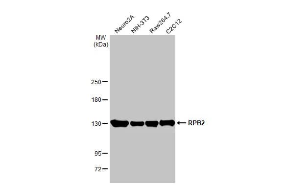 Western Blot: RPB2 Antibody (HL1042) [NBP3-13697] - Various whole cell extracts (30 ug) were separated by 5% SDS-PAGE, and the membrane was blotted with RPB2 antibody [HL1042] (NBP3-13697) diluted at 1:1000. The HRP-conjugated anti-rabbit IgG antibody  was used to detect the primary antibody.