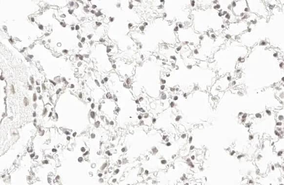 Immunohistochemistry-Paraffin: RPB2 Antibody (HL1042) [NBP3-13697] - RPB2 antibody [HL1042] detects RPB2 protein by immunohistochemical analysis.Sample: Paraffin-embedded mouse lung.RPB2 stained by RPB2 antibody [HL1042] (NBP3-13697) diluted at 1:100.Antigen Retrieval: Citrate buffer, pH 6.0, 15 min