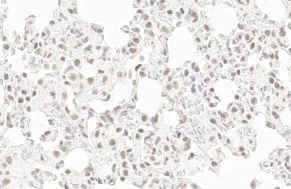 Immunohistochemistry-Paraffin: RPB2 Antibody (HL1042) [NBP3-13697] - RPB2 antibody [HL1042] detects RPB2 protein by immunohistochemical analysis.Sample: Paraffin-embedded rat lung.RPB2 stained by RPB2 antibody [HL1042] (NBP3-13697) diluted at 1:100.Antigen Retrieval: Citrate buffer, pH 6.0, 15 min