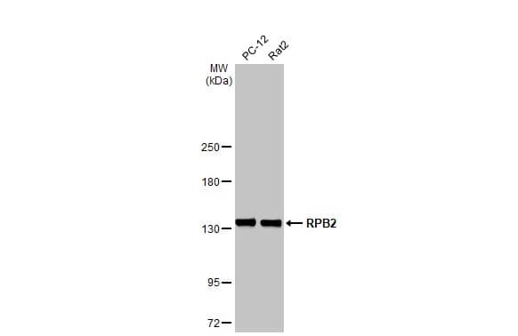Western Blot: RPB2 Antibody (HL1042) [NBP3-13697] - Various whole cell extracts (30 ug) were separated by 5% SDS-PAGE, and the membrane was blotted with RPB2 antibody [HL1042] (NBP3-13697) diluted at 1:5000. The HRP-conjugated anti-rabbit IgG antibody  was used to detect the primary antibody.