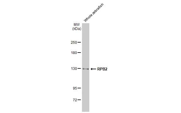 Western Blot: RPB2 Antibody (HL1042) [NBP3-13697] - Whole zebrafish extract (30 ug) was separated by 5% SDS-PAGE, and the membrane was blotted with RPB2 antibody [HL1042] (NBP3-13697) diluted at 1:1000. The HRP-conjugated anti-rabbit IgG antibody  was used to detect the primary antibody.
