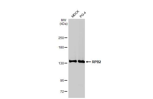 Western Blot: RPB2 Antibody (HL1042) [NBP3-13697] - Various whole cell extracts (30 ug) were separated by 5% SDS-PAGE, and the membrane was blotted with RPB2 antibody [HL1042] (NBP3-13697) diluted at 1:1000. The HRP-conjugated anti-rabbit IgG antibody  was used to detect the primary antibody.