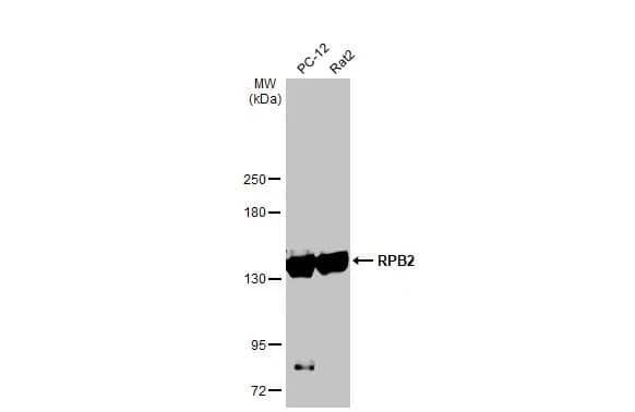 Western Blot: RPB2 Antibody (HL1043) [NBP3-13698] - Various whole cell extracts (30 ug) were separated by 5% SDS-PAGE, and the membrane was blotted with RPB2 antibody [HL1043] (NBP3-13698) diluted at 1:1000. The HRP-conjugated anti-rabbit IgG antibody  was used to detect the primary antibody.