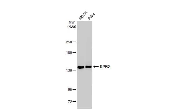 Western Blot: RPB2 Antibody (HL1043) [NBP3-13698] - Various whole cell extracts (30 ug) were separated by 5% SDS-PAGE, and the membrane was blotted with RPB2 antibody [HL1043] (NBP3-13698) diluted at 1:1000. The HRP-conjugated anti-rabbit IgG antibody  was used to detect the primary antibody.