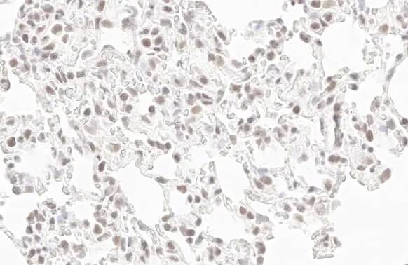 Immunohistochemistry-Paraffin: RPB2 Antibody (HL1043) [NBP3-13698] - RPB2 antibody [HL1043] detects RPB2 protein by immunohistochemical analysis.Sample: Paraffin-embedded rat lung.RPB2 stained by RPB2 antibody [HL1043] (NBP3-13698) diluted at 1:100.Antigen Retrieval: Citrate buffer, pH 6.0, 15 min