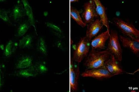 ICC/IF-RAB6A Antibody (HL1047) [NBP3-13701] - A549 cells were fixed in 4% paraformaldehyde at RT for 15 min.Green: RAB6A stained by RAB6A antibody [HL1047] diluted at 1:500.Red: alpha Tubulin, a cytoskeleton marker, stained by alpha Tubulin antibody [114] diluted at 1:1000.Blue: Fluoroshield with DAPI.