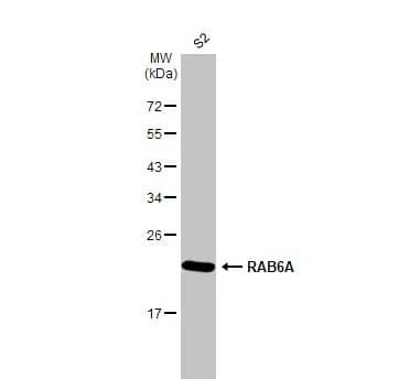 Western Blot: RAB6A Antibody (HL1047) [NBP3-13701] -Whole cell extract (30 ug) was separated by 12% SDS-PAGE, and the membrane was blotted with RAB6A antibody [HL1047] diluted at 1:1000. The HRP-conjugated anti-rabbit IgG antibody (NBP2-19301)) was used to detect the primary antibody.