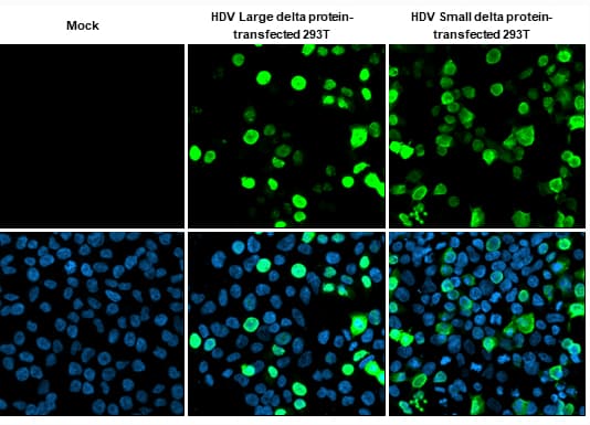 Hepatitis D virus Large delta + Small delta protein antibody [HL1055] detects Hepatitis D virus Large delta + Small delta protein protein by immunofluorescent analysis.Sample: Mock and transfected 293T cells were fixed in 4% paraformaldehyde at RT for 15 min.Green: Hepatitis D virus Large delta + Small delta protein stained by Hepatitis D virus Large delta + Small delta protein antibody [HL1055] diluted at 1:500.Blue: Fluoroshield with DAPI 