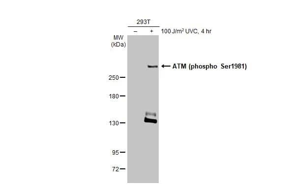 Untreated (-) and treated (+) 293T whole cell extracts (60 ug) were separated by 5% SDS-PAGE, and the membrane was blotted with ATM (phospho Ser1981) antibody [HL1062] (NBP3-13705) diluted at 1:1000. The HRP-conjugated anti-rabbit IgG antibody  was used to detect the primary antibody. 
