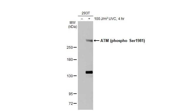 Untreated (-) and treated (+) 293T whole cell extracts were separated by 5% SDS-PAGE, and the membrane was blotted with ATM (phospho Ser1981) antibody [HL1062] (NBP3-13705) diluted at 1:1000. The HRP-conjugated anti-rabbit IgG antibody  was used to detect the primary antibody. 