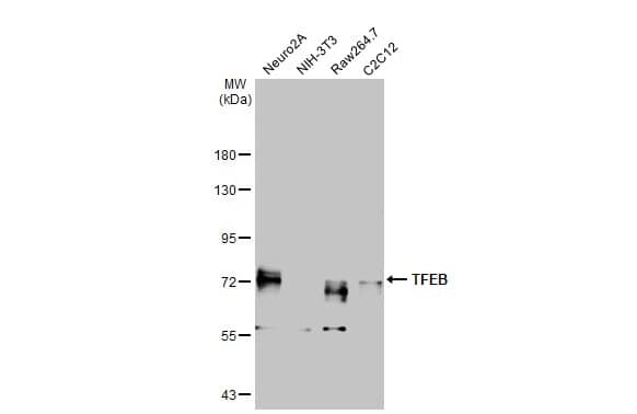 Western Blot: TFEB Antibody (HL1065) [NBP3-13706] - Various whole cell extracts (30 ug) were separated by 7.5% SDS-PAGE, and the membrane was blotted with TFEB antibody [HL1065] (NBP3-13706) diluted at 1:5000. The HRP-conjugated anti-rabbit IgG antibody  was used to detect the primary antibody.