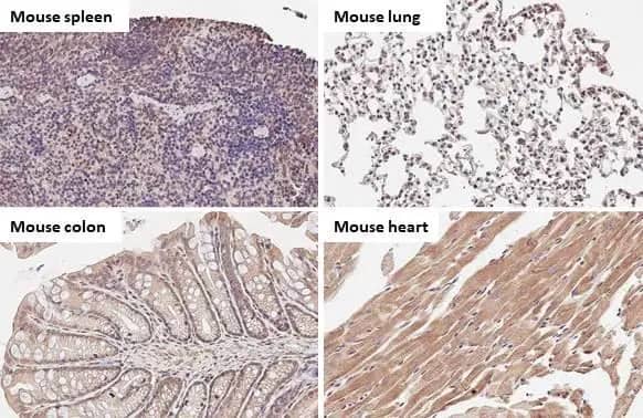 Immunohistochemistry-Paraffin: TFEB Antibody (HL1065) [NBP3-13706] - TFEB antibody [HL1065] detects TFEB protein at cytoplasm and nucleus by immunohistochemical analysis.Sample: Paraffin-embedded mouse tissues.TFEB stained by TFEB antibody [HL1065] (NBP3-13706) diluted at 1:100.Antigen Retrieval: Citrate buffer, pH 6.0, 15 min