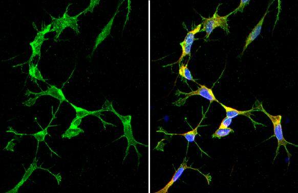 SARM1 antibody [HL1066] detects SARM1 protein by immunofluorescent analysis.Sample: SH-SY-5Y cells were fixed in 4% paraformaldehyde at RT for 15 min.Green: SARM1 stained by SARM1 antibody [HL1066] (NBP3-13707) diluted at 1:500.Red: alpha Tubulin, a cytoskeleton marker, stained by alpha Tubulin antibody [GT114]  diluted at 1:1000.Blue: Fluoroshield with DAPI . 