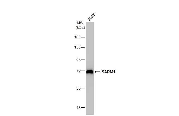 Western Blot: SARM1 Antibody (HL1070) [NBP3-13710] - Whole cell extract (30 ug) was separated by 7.5% SDS-PAGE, and the membrane was blotted with SARM1 antibody [HL1070] (NBP3-13710) diluted at 1:1000. The HRP-conjugated anti-rabbit IgG antibody  was used to detect the primary antibody.